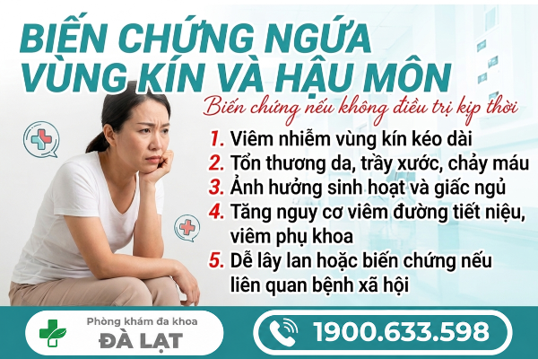 Hình ảnh minh họa